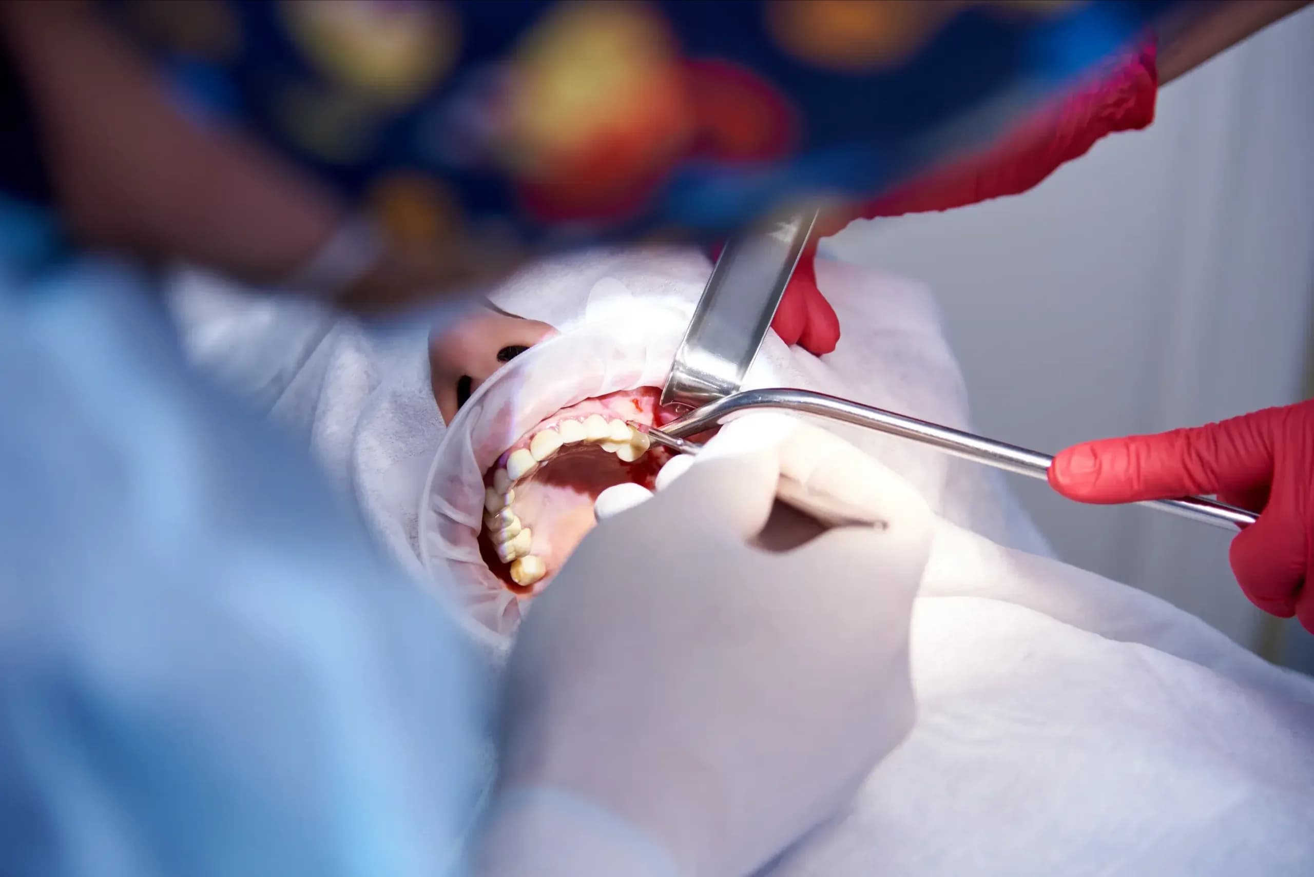 Igienizare dentară la clinica Elmadenta