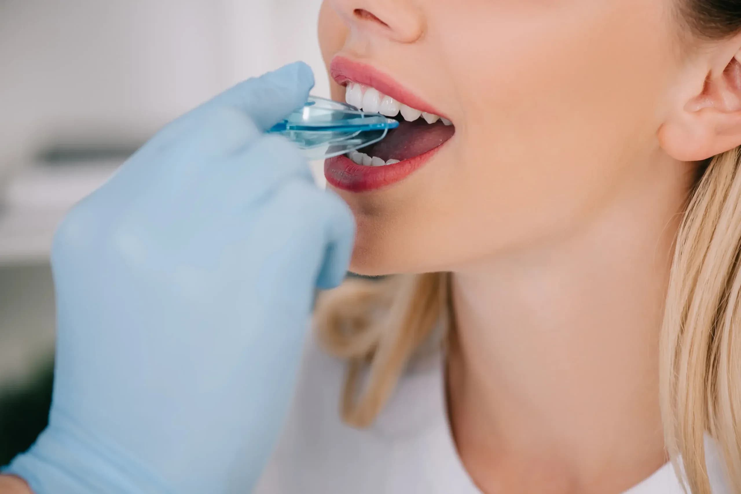 Tratament ortodontic la clinica Elmadenta