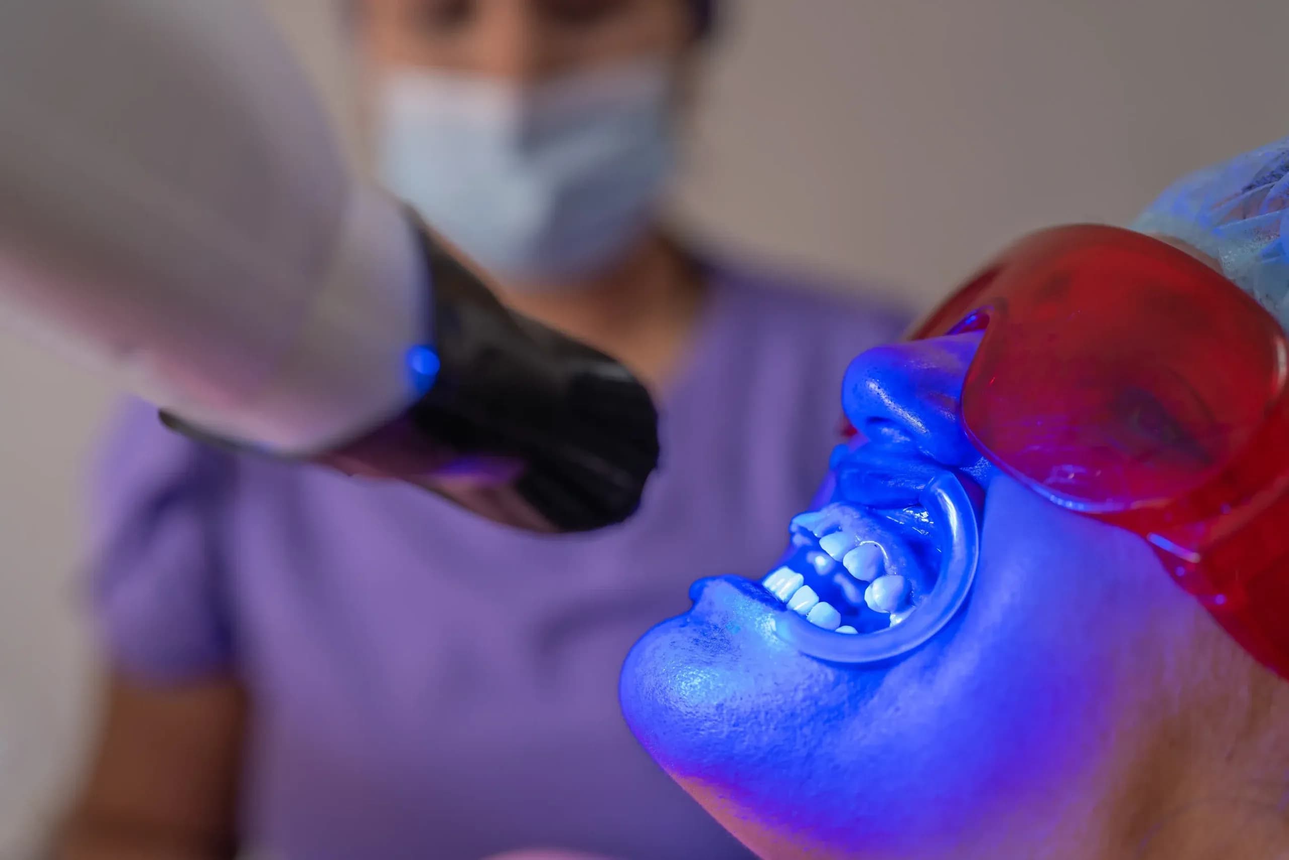 Albire dentară la clinica Elmadenta