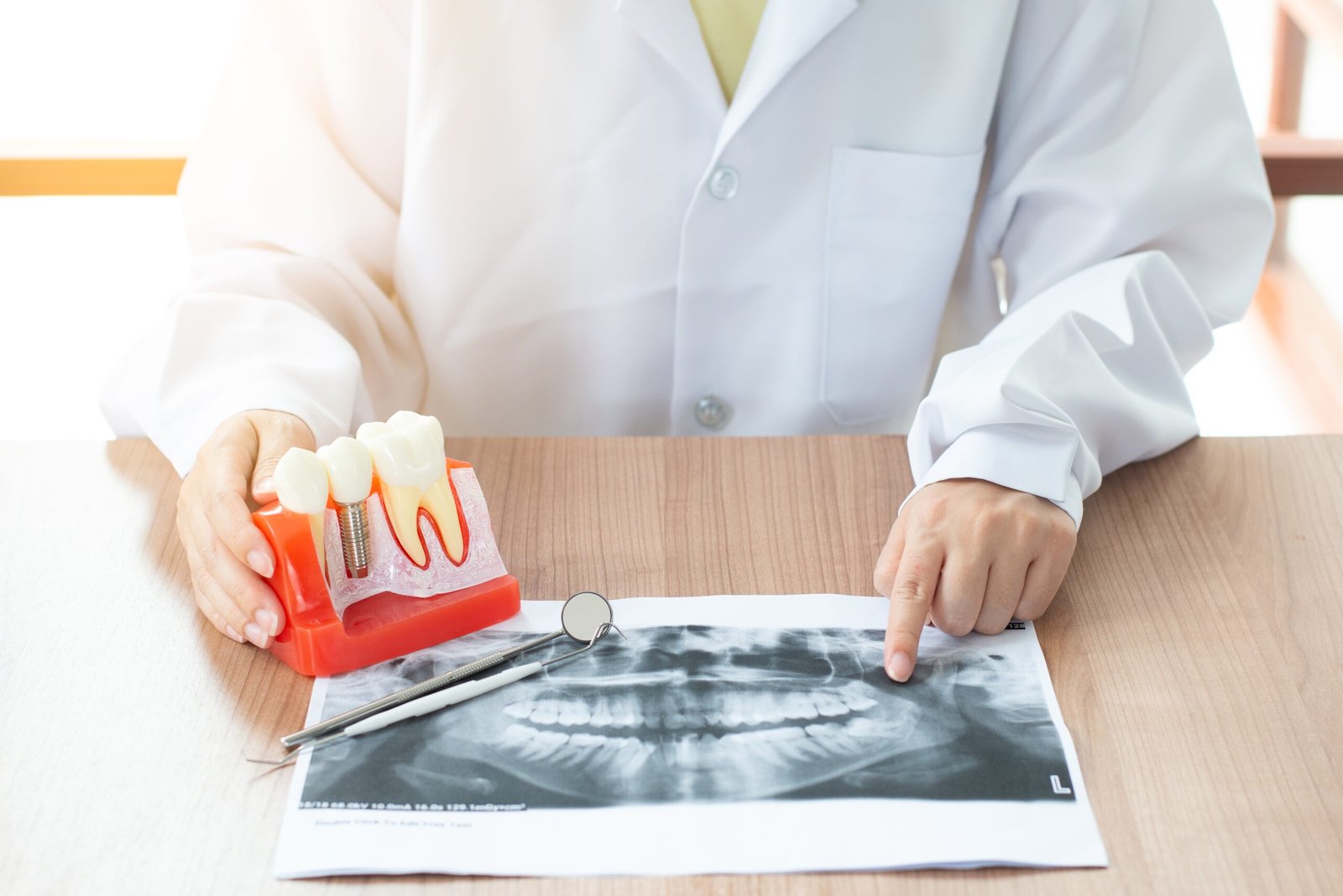 Implant Dentar Bucuresti