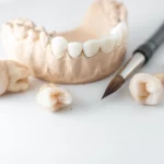 Parodontoza sector 3